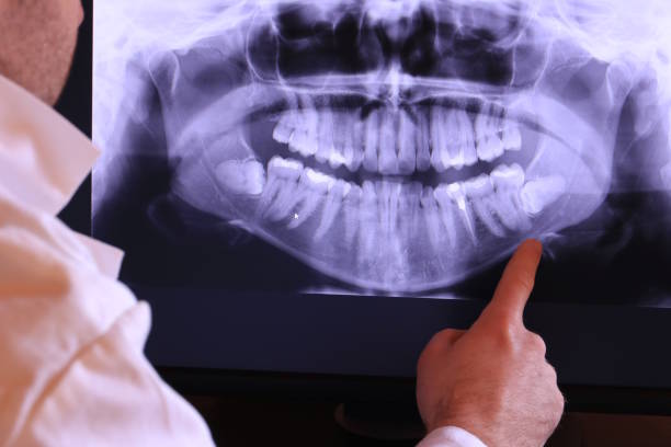 Best Emergency Dental Care for Sports Injuries in Bushnell, IL